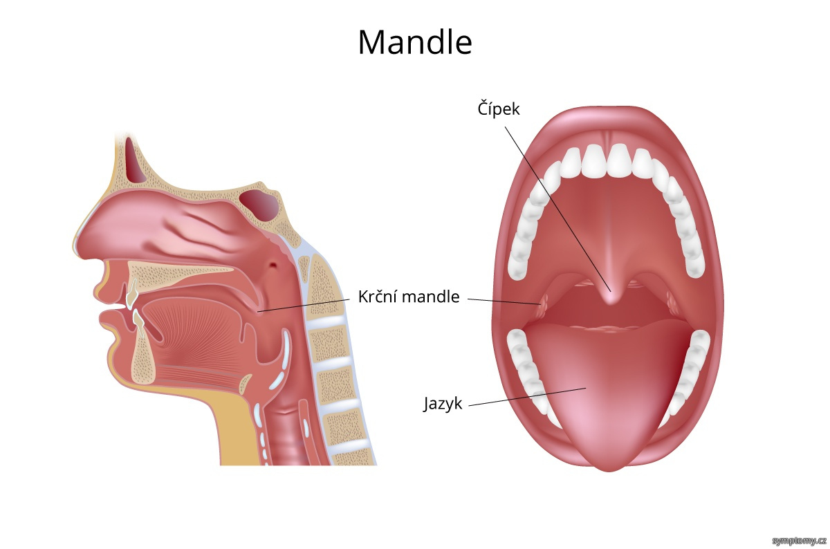 Kde bolí mandle?