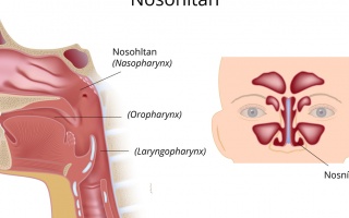 Nosohltan