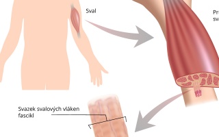 Příčně pruhovaná svalovina kosterní