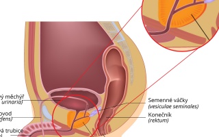 Prostata