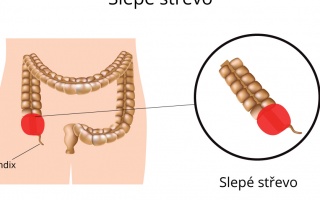 Slepé střevo