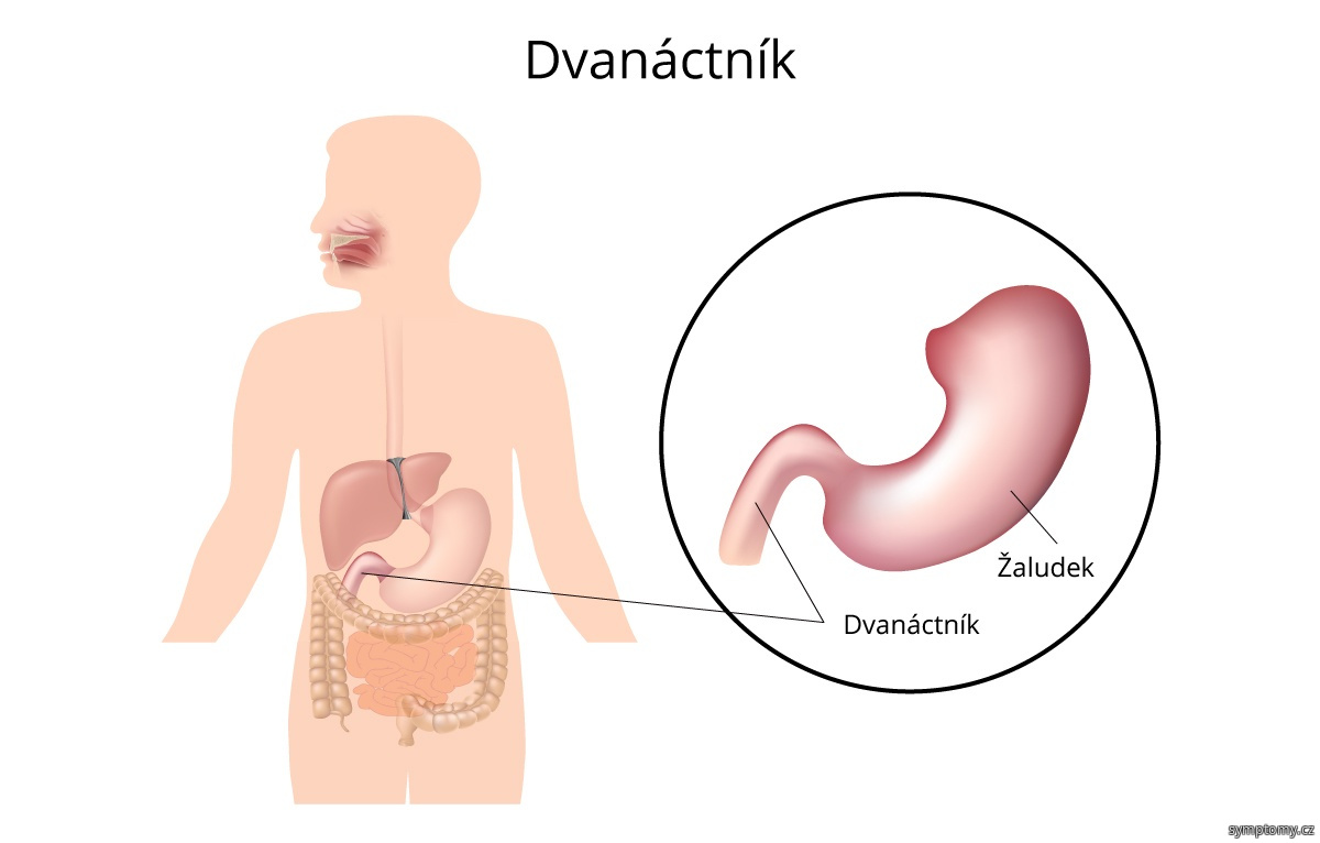 Co pomaha na Dvanacterniku?