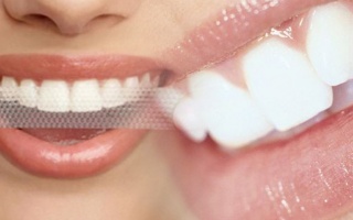 Bělící pásky na domácí bělení zubů