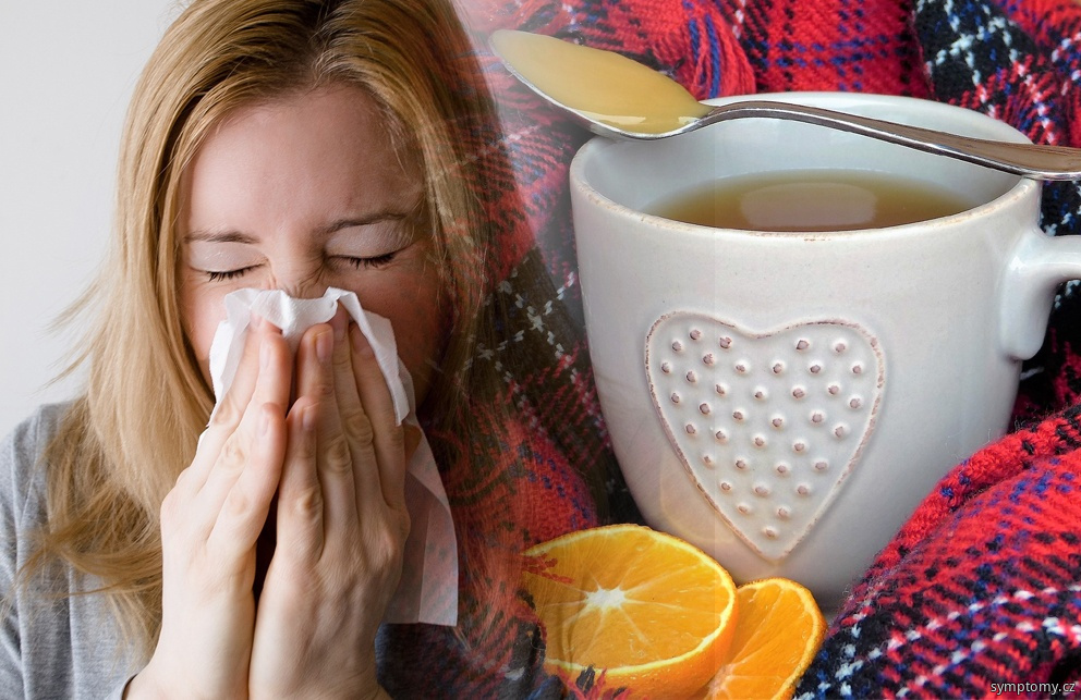 chřipková epidemie