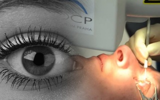 Laserové operace očí