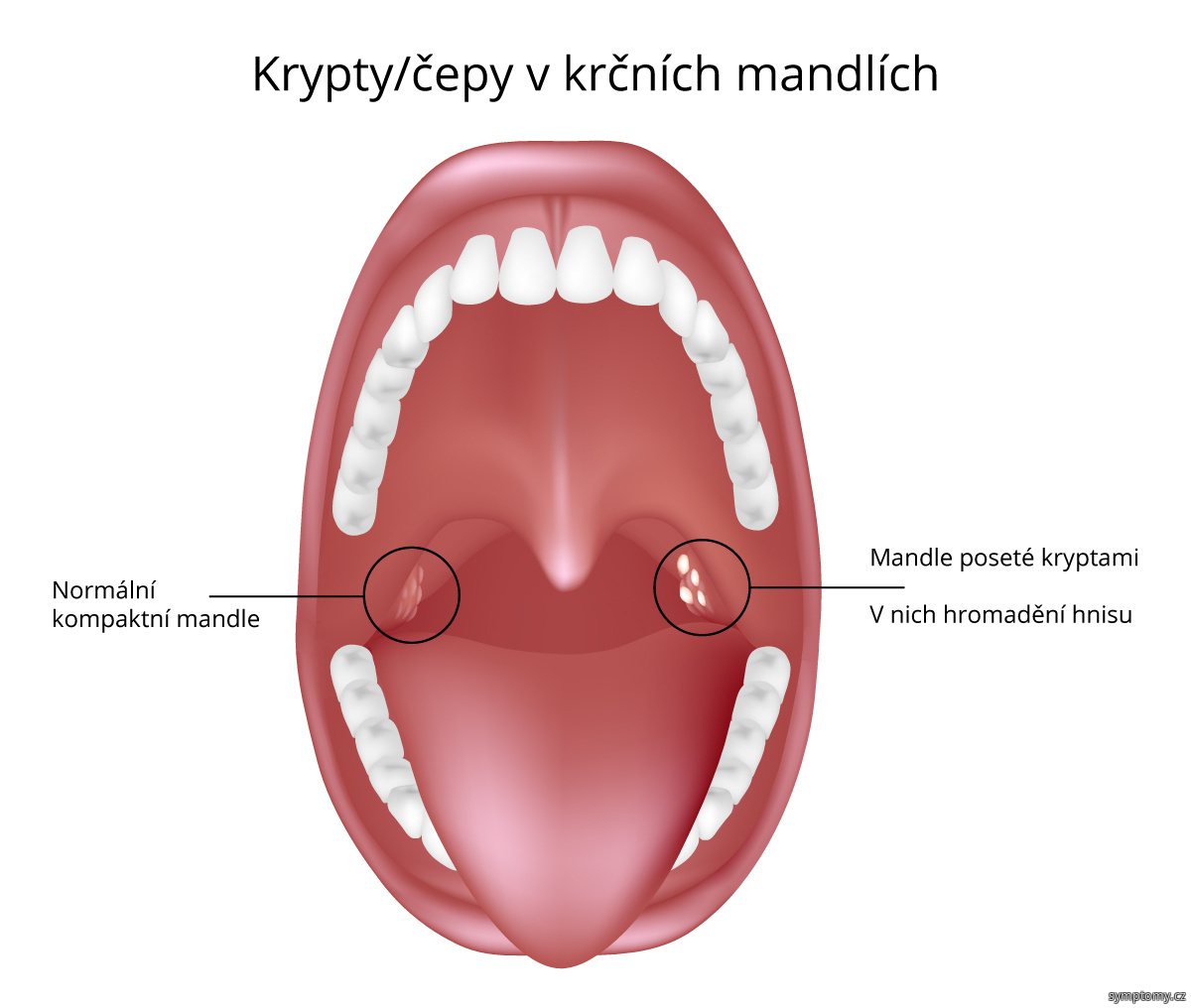 Co je v mandlích?