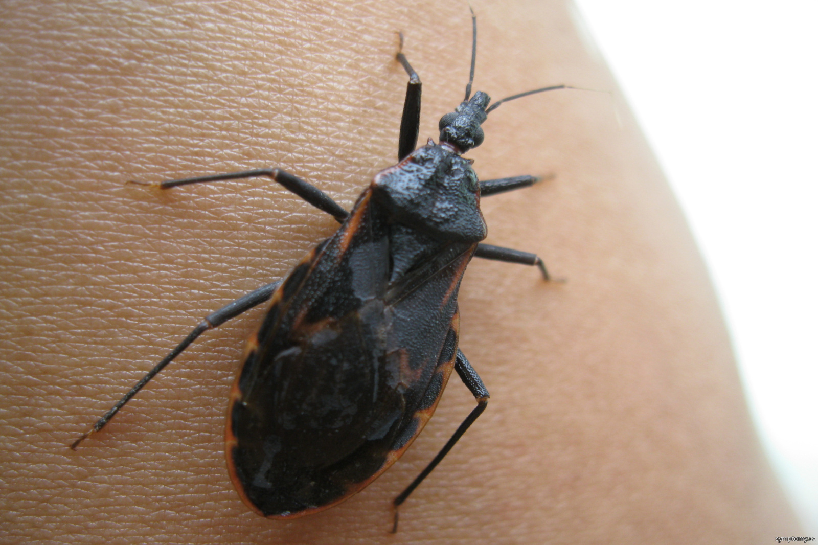 Ploštice - Chagasova nemoc