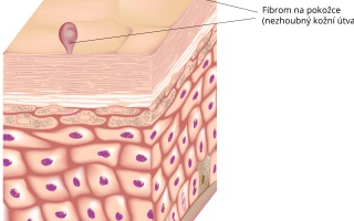 Fibrom