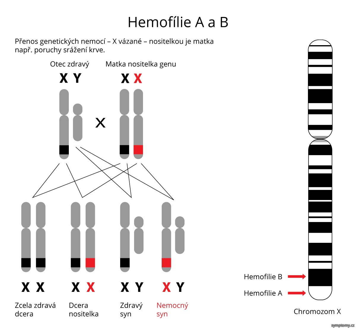 Přenos genetických nemocí - Hemofílie A a B