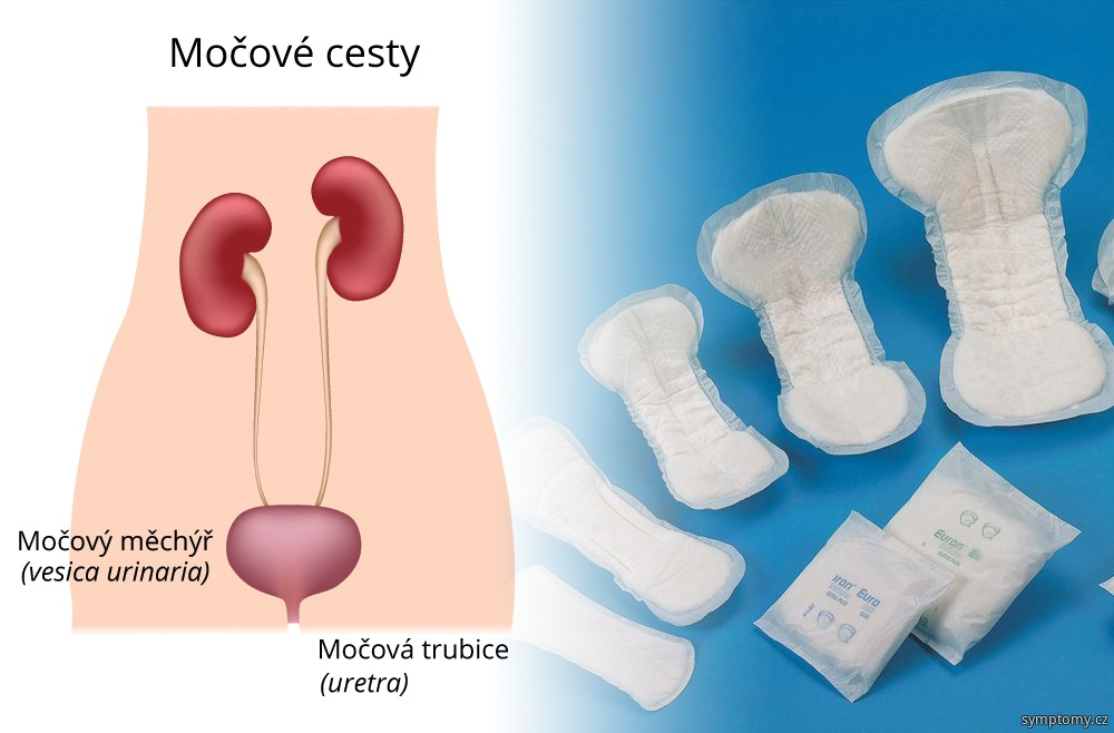 Jak se projevuje samovolný únik moči?