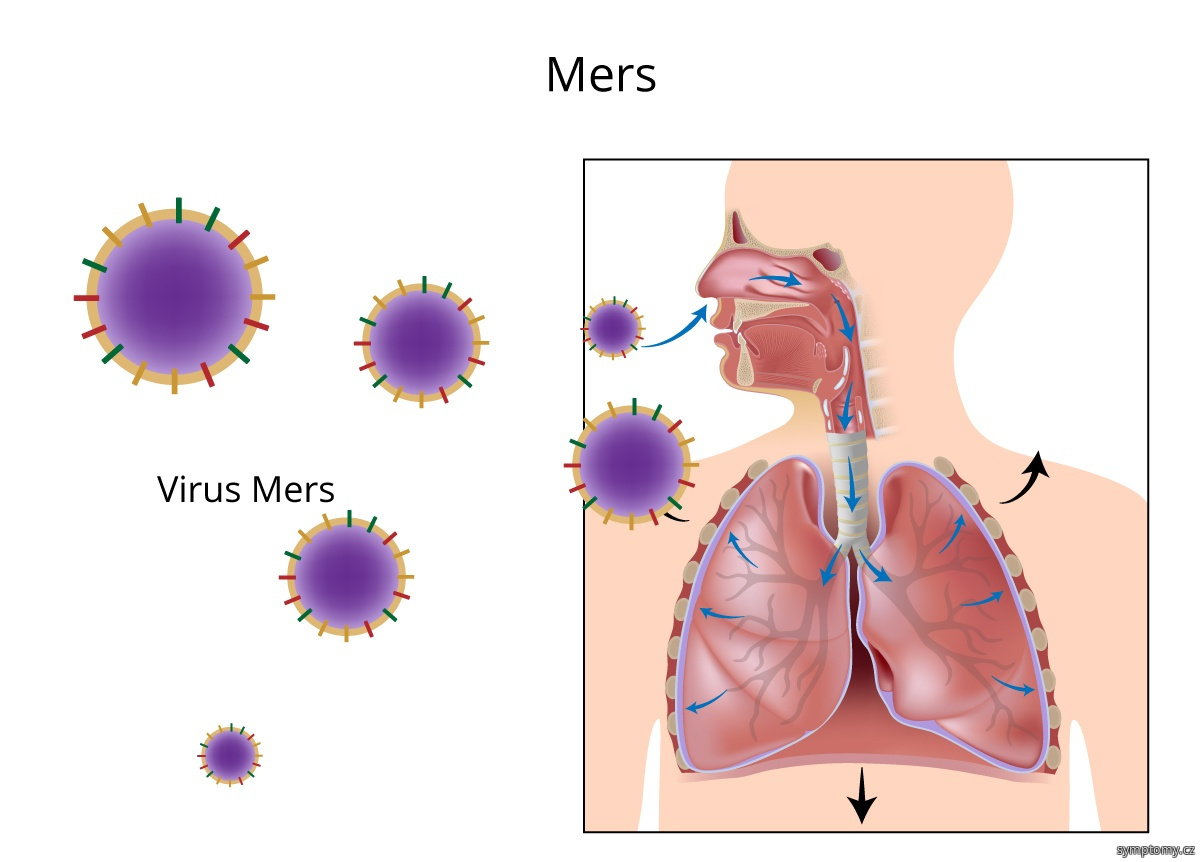 MERS - jedna z forem koronaviru