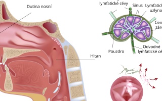 Non-Hodgkinův lymfom