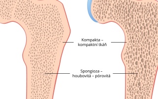 Osteoporóza