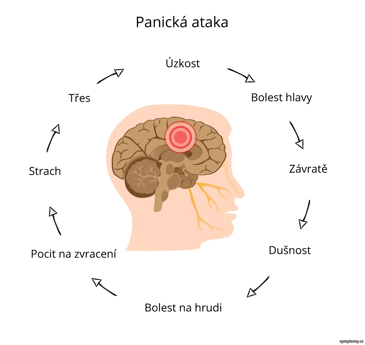 Co je úzkostná Ataka?