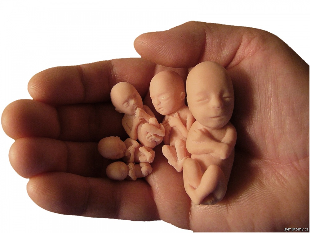 Etapy vývoje embrya a plodu