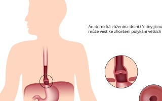 Schatzkiho prstenec
