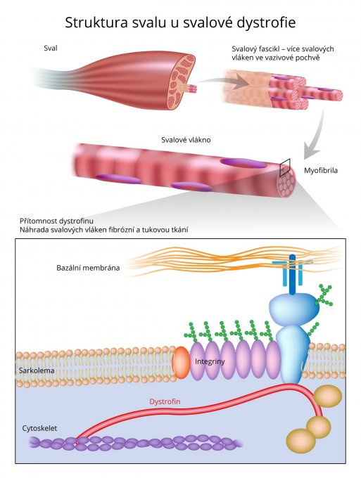 Struktura svalu u svalové dystrofie