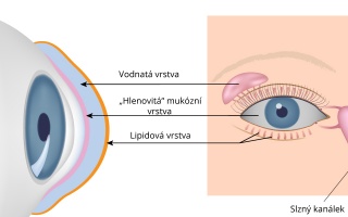 Syndrom suchého oka