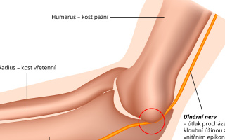 Útlak ulnárního nervu
