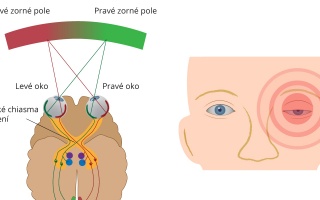 Výpadek zorného pole