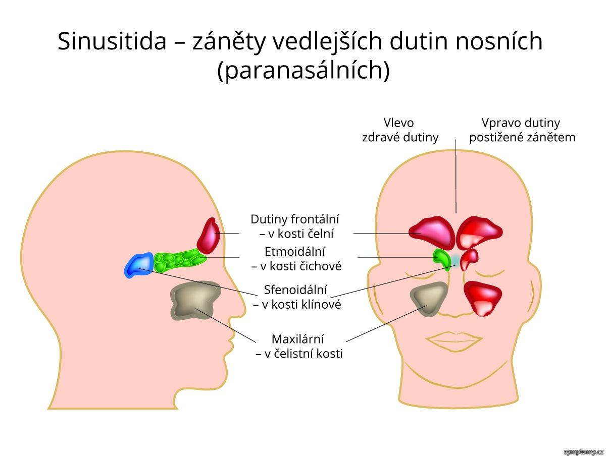 Jak bolí dutiny?