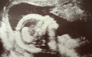 Pátý měsíc těhotenství