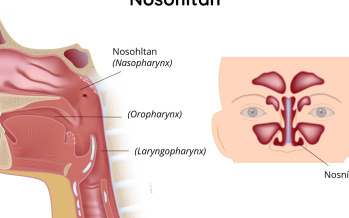 Nosohltan