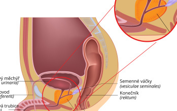 Prostata