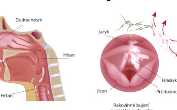Metastázy