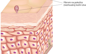 Fibrom