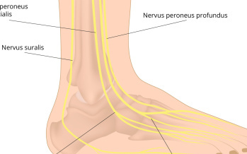 Neuropatie