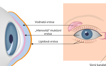 Syndrom suchého oka