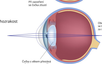 Vetchozrakost