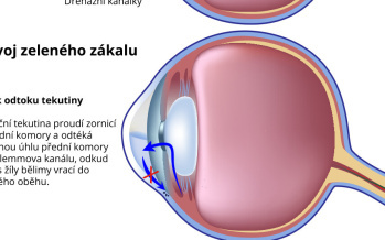 Zelený zákal