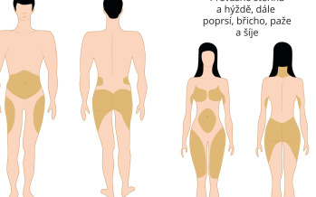 Rozdíly v rozložení podkožního tuku u mužů a žen