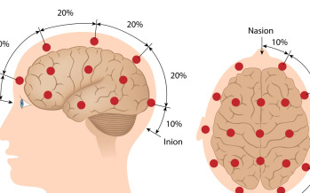EEG