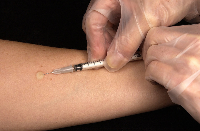 Alergologický test