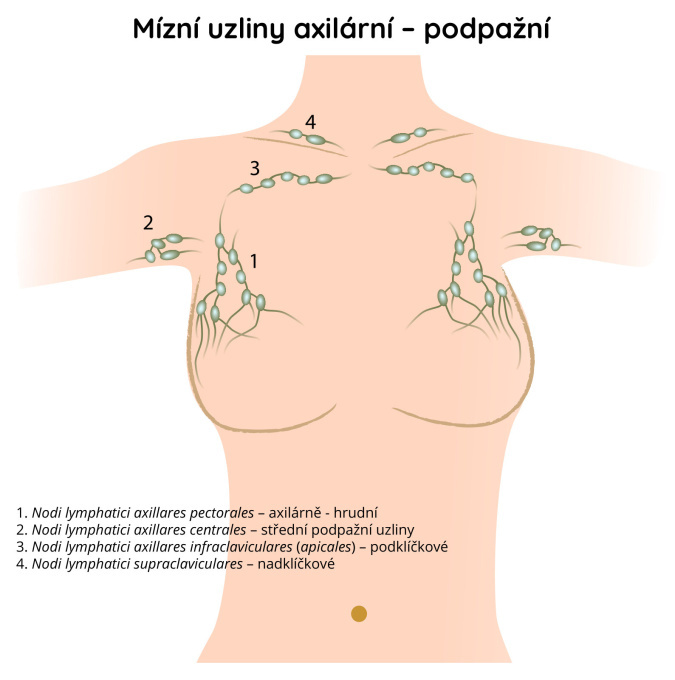 Mízní uzliny axilární – podpažní