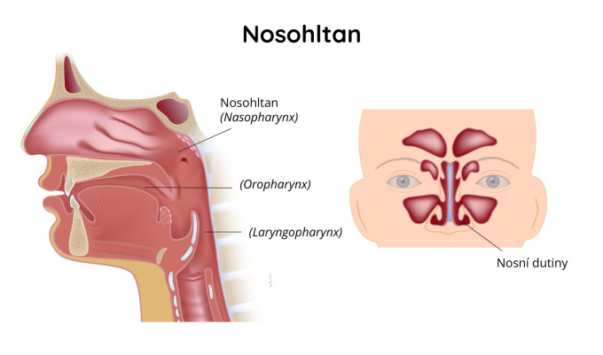 Nosohltan
