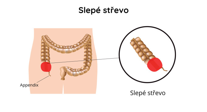 Slepé střevo