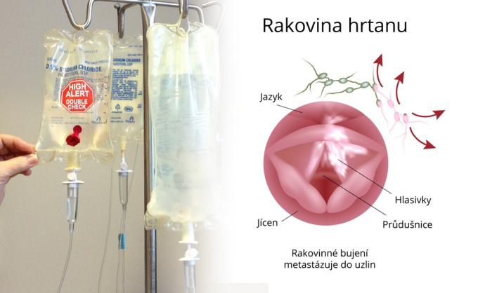 Léky na rakovinu