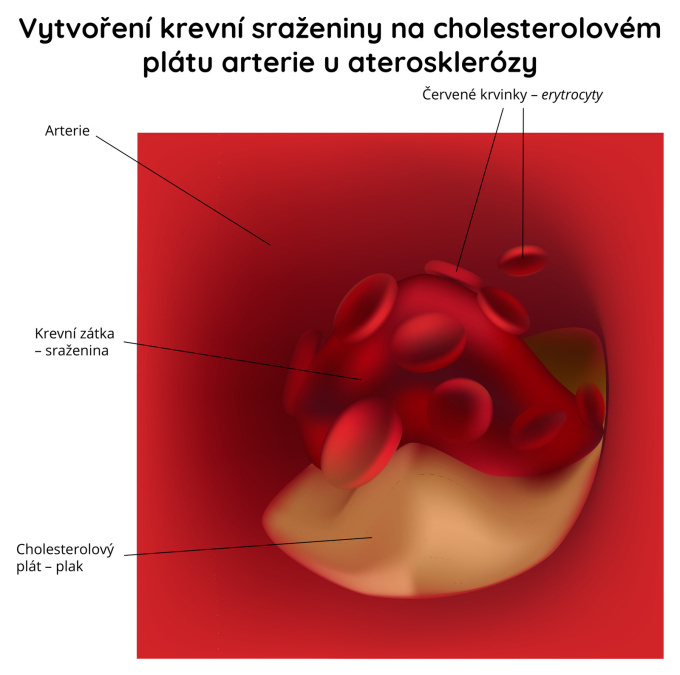 Srážení krve