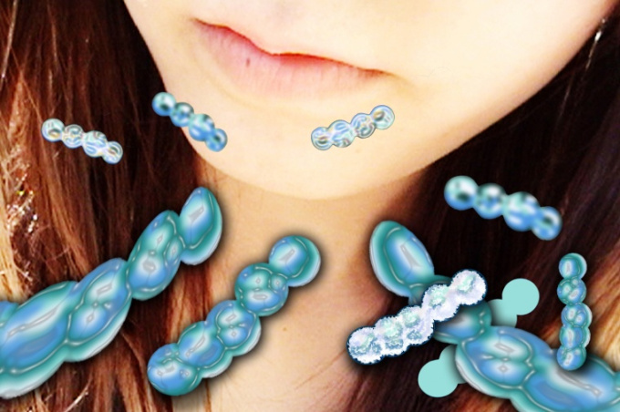 Streptococcus a angína