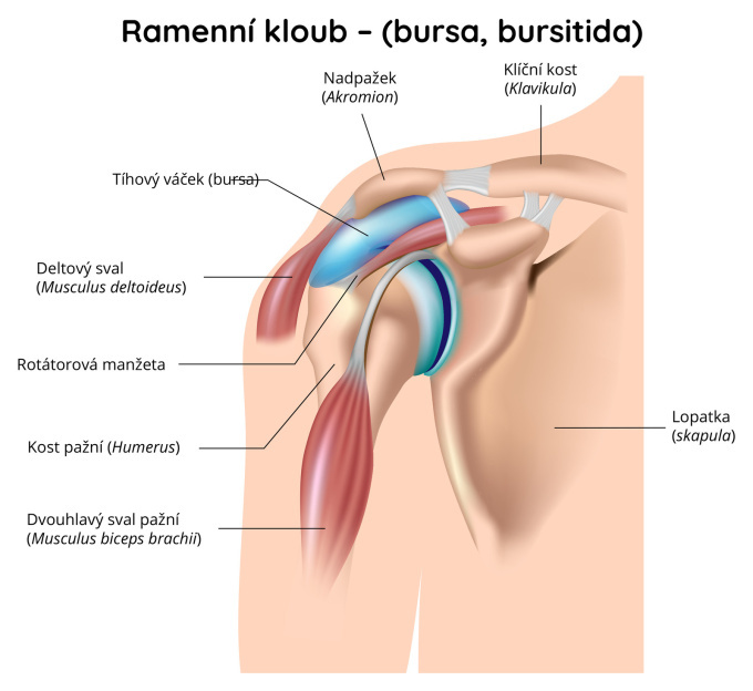 Ramenní kloub – bursa, bursitida
