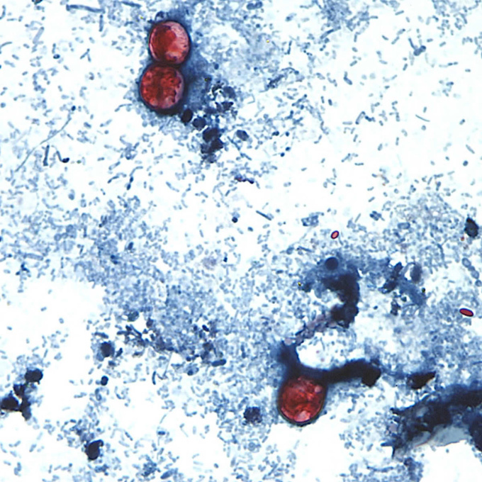 Oocysty Cyclospora cayetanensis ve vzorku stolice