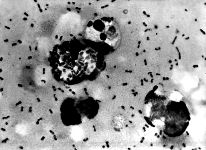Yersinia pestis