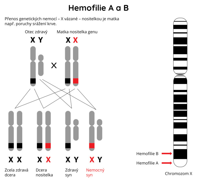 Přenos genetických nemocí - Hemofílie A a B