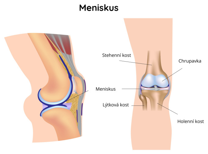 Meniskus