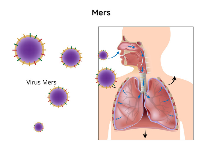 MERS - jedna z forem koronaviru