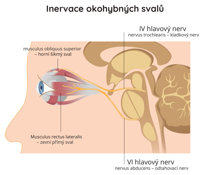 Poruchy inervace okohybných svalů
